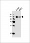 DPYS Antibody (C-term)